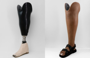 Before and after Silicone cover on prosthetic leg