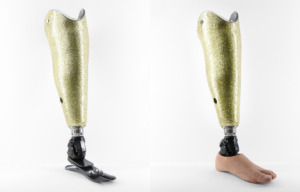 Before & after Prosthetic silicone Foot shell