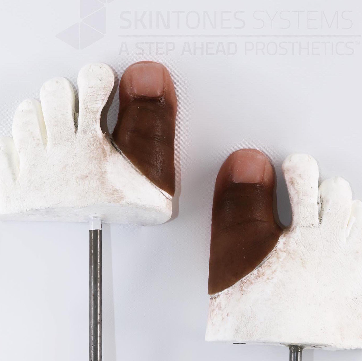 missing toe prosthesis